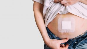 Lifestyle Changes to Keep You Safe from Hernias