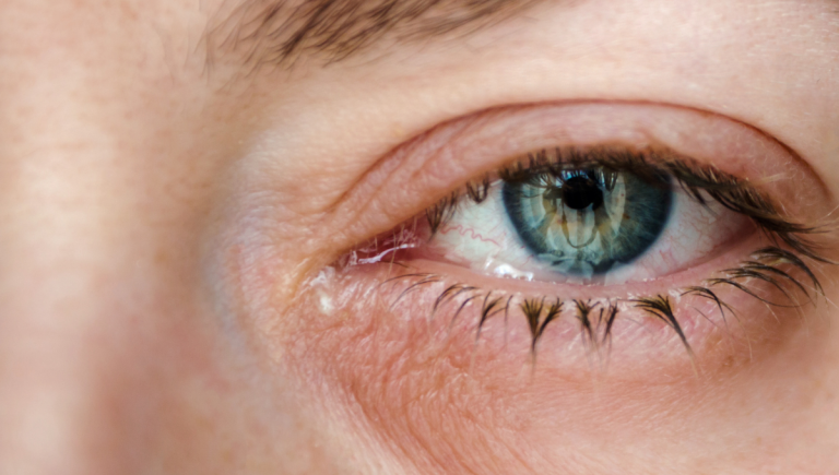 5 Eye Problems an Optometrist Can Help You Solve