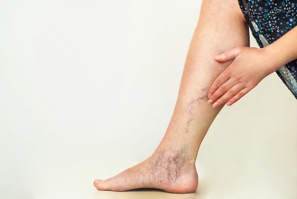 Best Approaches to Reverse the Symptoms of Venous Insufficiency