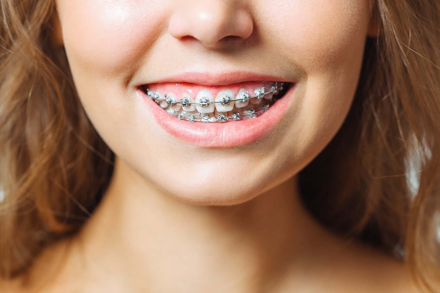 8 Orthodontic Problems That Invisalign Treatments Solve