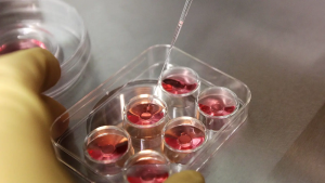 Nuances of egg freezing